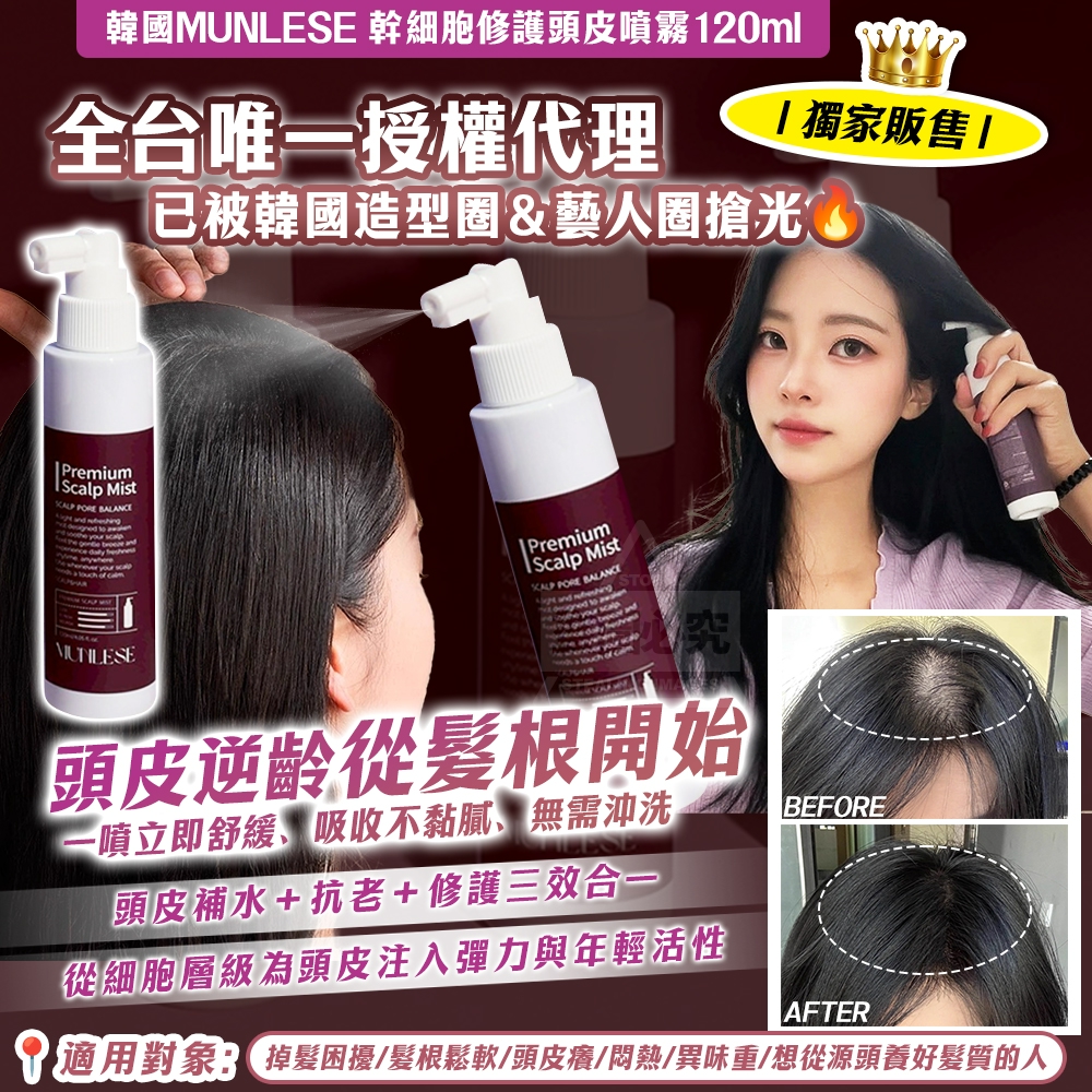 獨家販售 韓國製造 MUNLESE 修護頭皮噴霧｜頭皮逆齡從髮根開始 120ml